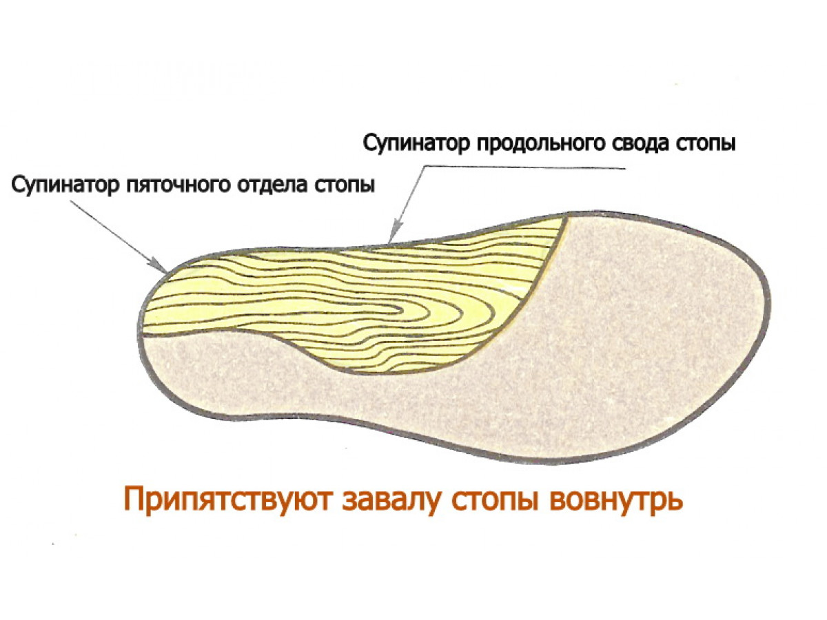 Ортопедическая стелька ВП2